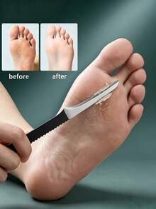 6pcs Professional Pedicure Tool Set, Stainless Steel Foot Care Kit, Suitable For Thick Nails, Dead Skin & Callus Remover, With Storage Box - Black - View 3