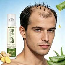 SUMIFANG Ginger & Rosemary Scalp Serum With Rollerball, Enriched With Ginger, Rosemary And Multiple Plant Extracts, Repairs Scalp And Nourishes Hair Roots, Improves Fine And Flat Hair Texture, Direct Application To Hair Roots, Refreshing And Fast Absorbing, 15ml - Full Size - View 1