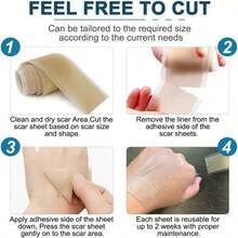 Transparent Silicone Tape, Flexible Breathable Non-Woven Fabric Material, Universal Type, Suitable For Hands And Feet (2.5cm*0.5m) - Apricot - View 3