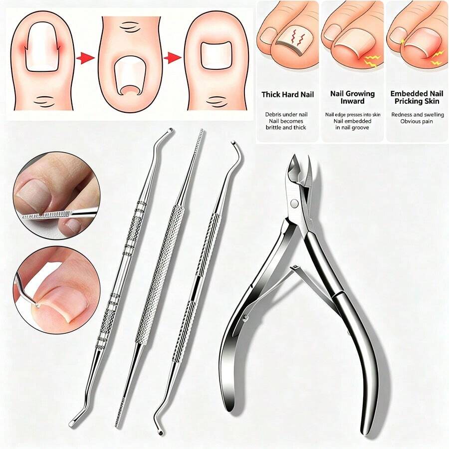 4pcs Silver Ingrown Toenail Removal Set, Stainless Steel Toenail File And Lifter, Stainless Steel Ingrown Toenail Clipper, Professional Pedicure Cleaning Tools For Ingrown Toenail Treatment - A - View 1