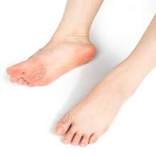 1pc Transparent Ring-Shaped Silicone Foot Protector, Unisex, Anti-Friction Cushioning Pressure Relief Pad, Adhesive Forefoot & Heel Foot Protection Patch - Clear - View 6