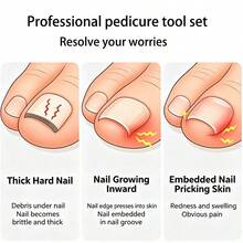 4pcs Silver Ingrown Toenail Removal Set, Stainless Steel Toenail File And Lifter, Stainless Steel Ingrown Toenail Clipper, Professional Pedicure Cleaning Tools For Ingrown Toenail Treatment - A - View 8