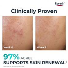Eucerin يوسيرين ديرموبيور كلينيكال بيليينج 10 40 مل - مركب هيدروكسي، سيروم، مستحضرات تجميل علاجية - حمض الساليسيليك - مشاهدة 9