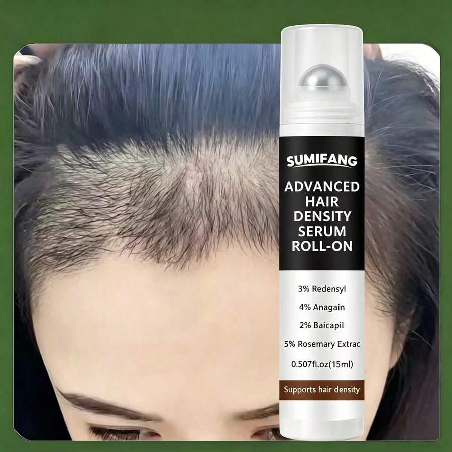 SUMIFANG No-Rinse Rollerball Scalp Serum, Rich In Hair Care Ingredients, Nourishes And Repairs Scalp, Strengthens Hair Roots, Improves Fine And Flat Hair, Apply Directly To Hair Roots, Refreshing Texture, Fast Absorption, 15ml - Full Size - View 1