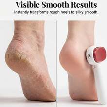 1pc Double-Sided Foot Care Tool, Replaceable Blade Dead Skin Remover, Portable Manual Foot Exfoliating Tool, Suitable For Thick Hard Cracked Skin, Foot Care Tool - Multiple Styles - View 8