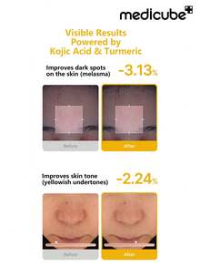 Medicube Kojic Acid & Turmeric 淨化棉片，舒緩修護棉片，含麴酸、薑黃、菸鹼醯胺、甘醇酸，適用於問題肌膚、痘後護理，韓系保養，70片/包，1包 - 70 片 - 查看 5