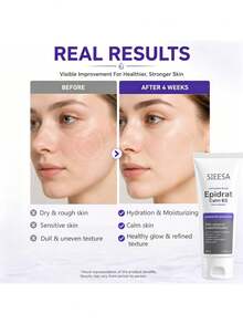 Pelembap Wajah B5 Multi-Repair, Hidrasi Mendalam, Menenangkan Kulit Sensitif, Ringan & Tidak Berminyak, Membuat Kulit Terlihat Halus dan Lembut - SA634 - View 8