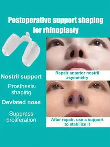 Adjustable Transparent Silicone Nose Clip - Improves Breathing, Comfortable And Durable, Suitable For Snoring And Nasal Congestion Relief, Easy To Clean, Portable - Fits Various Nostril Sizes, Anti-Snoring Device - Multicolor - View 6