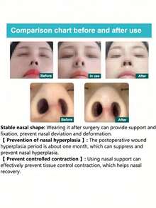 Adjustable Transparent Silicone Nose Clip - Improves Breathing, Comfortable And Durable, Suitable For Snoring And Nasal Congestion Relief, Easy To Clean, Portable - Fits Various Nostril Sizes, Anti-Snoring Device - Multicolor - View 5