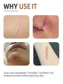 2/4pcs Of Silicone Gel Scar Patch, Self-Adhesive Scar Concealer, Matches Human Skin Tone, Invisible Coverage, Breathable And Comfortable, Suitable For Various Social Occasions, Such As Meetings, Dates, Dinners, And Ceremonies. - Skin-colored Scar Patch - View 2
