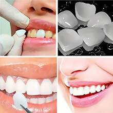 50pcs/Set Exquisite Versatile DIY Temporary Teeth Whitening Veneers Suitable For Men And Women Holiday Party Daily Wear Elegant Gift (Excluding Solid Adhesive Glue) - Multicolor - View 1