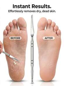 2pcs [Foot Repair Knife+Storage Box] Professional Stainless Steel Pedicure Knife And Dual-Ended Callus Remover - Precision Foot Care Tool For Dead Skin And Cuticle Maintenance - A - View 2