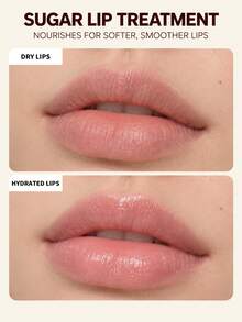 Fresh Sugar Advanced Therapy Lip Balm 4.3g - Net Wt. 0.15 Oz - SOFT & HYDRATED-4.3g - View 8