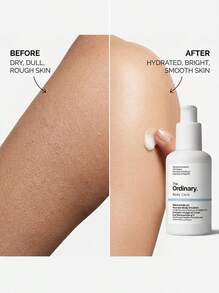 The Ordinary Niacinamide 5% Face And Body Emulsion 100 Ml – Emulsion, Brightening, For All Skin Types, Niacinamide, Suitable For Daily Skincare Routine - White - View 4
