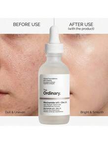 The Ordinary Niacinamide 10% + Zinc 1% Serum 60 Ml – Face Serum, Blemish Control, For Oily Skin, Vitamin B3, Suitable For Daily Skincare Routine - Clear - View 5