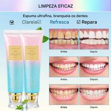 2 Unidades Creme Dental com Niacinamida, Remove Manchas Dentárias, Proporciona Hálito Fresco, Cuidado Bucal Diário - pasta de dente - Visão 5