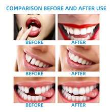 JAYSUING Teeth Decoration, Party Event Decoration, Non-Adhesive, Silicone Filled Product - Multicolor - View 4