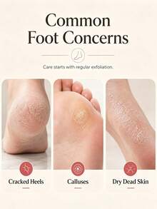 1/2pcs Double-Sided Foot Scraper, Curved Dead Skin Remover, Foot Trimming File Tool For Cracked Heels - Multicolor - View 6