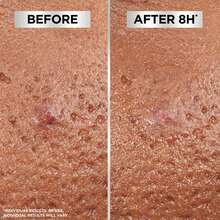 Garnier Acne Patches & Nose Patches - Halloween - View 6