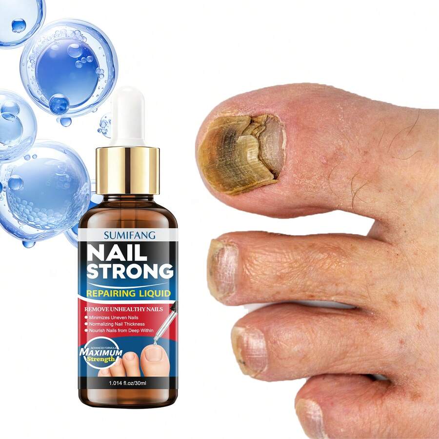 Krim Essence Perbaikan Kuku Kolagen 30ml, Diformulasikan dengan Gliserin dan Kolagen, Menguatkan dan Melembapkan Kuku, Melindungi Kuku Secara Efektif, Cocok untuk Perawatan Kuku Sehari-hari - 1PC - View 1