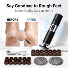1200mAh Professional Electric Foot Exfoliator, Type-C Interface And LCD Display, Equipped With 20 Adjustable Sandpaper Grinding Discs, One-Touch Easy Operation, Suitable For Beginners, Unisex Foot Care Tool - View 2