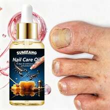 Essence Perawatan Kuku 30ml, Menutrisi Kuku dengan Lembut, Memperbaiki Kuku yang Lemah, Menguatkan Permukaan Kuku. Ringkas dan Portabel, Cocok untuk Perawatan Kuku Sehari-hari. - 1PC - View 7