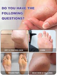 5 Packs Foot Peel Mask | Exfoliating Foot Masks For Dry, Cracked Feet Moisturize & Hydrate/Soft Rough Feet/Care For Light Beige Feet/Moisturizing And Nourishing Foot Mask Care - View 2