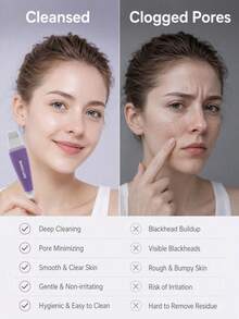 1pc Double-Ended Blackhead Remover, Stainless Steel Facial Skin Scraper, Portable Pore Cleaning Tool With Protective Cap, Manual Facial Cleansing Beauty Tool, Suitable For Blackheads And Dead Skin - Multicolor - View 6