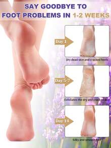 5 Packs Foot Peeling Mask,Exfoliator Peel Mask ,Foot Peel Masks For Men And Women Feet Peeling Mask Natural Ingredient Design, Moisturizing Exfoliator Foot Mask - View 6