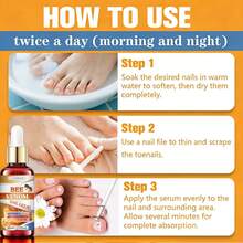 Cairan Perawatan Kuku Racun Lebah, Esensi Bergizi untuk Kuku Tangan dan Kaki, Memperbaiki Permukaan Kuku yang Kering dan Kasar, Memperkuat Kualitas Kuku untuk Perawatan Harian, 30ml - 30 ml - View 6