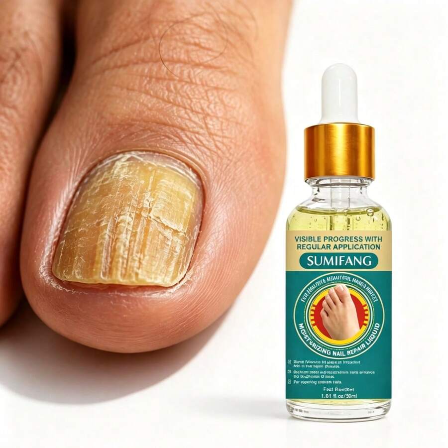 30ml Moisturizing Repairing Nail Lotion, Contains Glycerin, Collagen And Niacinamide, Effectively Moisturizes And Strengthens Nails, Fast-Acting, Suitable For Hands And Feet - 1PC - View 1
