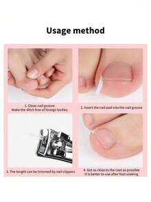 Ingrown Toenail Patch, Foot Care And Nail Repair Tool - Multicolor - View 5