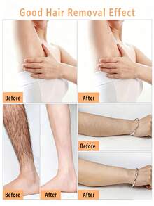 200/100/50PCS Disposable Waxing Strips And Hair Removal Cloth, Non-Shedding With No Residue, Ideal For Removing Leg And Arm Hair-Hair Removal Aid Tool - White - View 3
