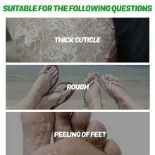 EELHOE Hand & Foot Mask - 1 - View 3
