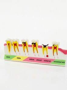 1pc Colorful Tooth Decay Progression Model, Suitable For Children's Science Exhibition Or Clinic Decoration, Avant-Garde Educational Medical Aesthetic - 1pc - View 10