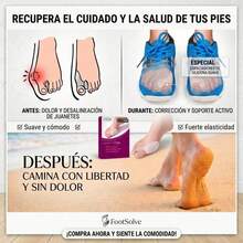 Bunion Pads - View 6
