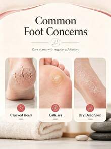 1pc New Double-Sided Foot Callus Scraper – Curved Dead Skin Remover; Effectively Removes Stubborn Dead Skin; Stainless Steel Foot Care File; Suitable For Cracked Heels; Home Foot Care Tool; Pedicure Accessory. - Multiple Styles - View 4