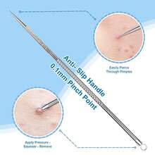 Double-Ended Acne Extractor Tool Set, Blackhead And Pimple Removal Tool ...