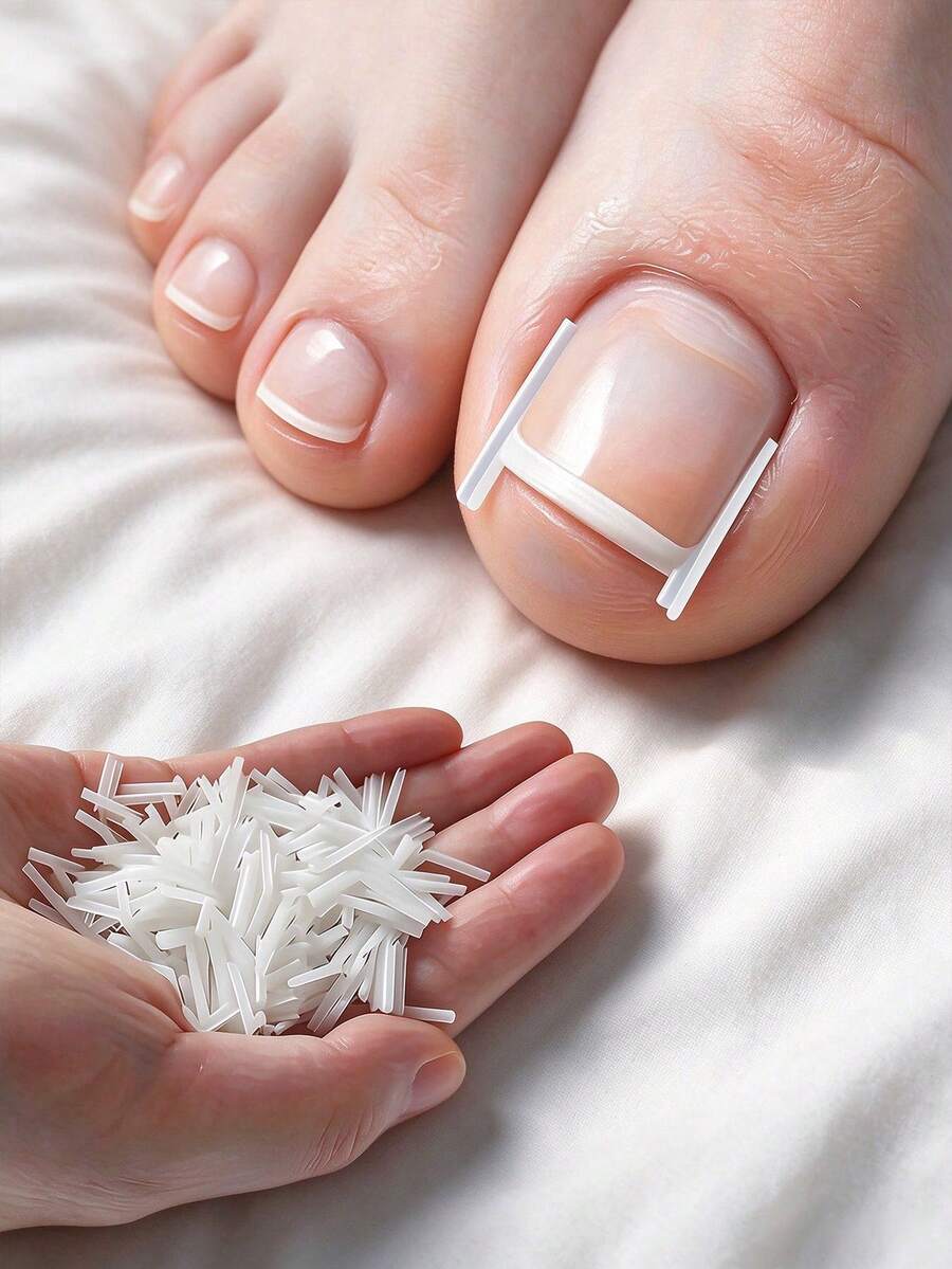 20-200pcs Embedded Long Toenail Strips, Transparent Toenail Correction Treatment Set, Fragrance-Free Toenail Care Pad Set, Professional Toenail Lining, Toenail And Foot Care Tools - Multi-color - View 1