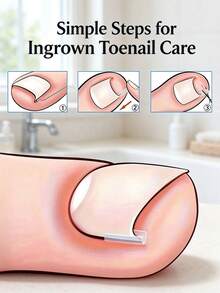 20-200pcs Embedded Long Toenail Strips, Transparent Toenail Correction Treatment Set, Fragrance-Free Toenail Care Pad Set, Professional Toenail Lining, Toenail And Foot Care Tools - Multi-color - View 4