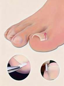 20-200pcs Embedded Long Toenail Strips, Transparent Toenail Correction Treatment Set, Fragrance-Free Toenail Care Pad Set, Professional Toenail Lining, Toenail And Foot Care Tools - Multi-color - View 6