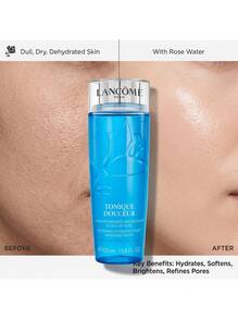 Lancôme Tonique Douceur 400 Ml – Rose Water Infused, Softening And Hydrating For All Skin Types, Alcohol-Free Pore Refining, Smoothing Skin Texture, Morning And Evening Skincare, Daily Face Hydration, Luxury Beauty Essential - White - View 4