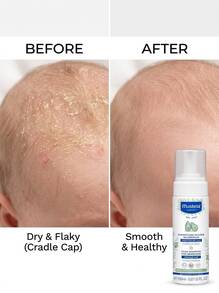 Mustela Foam Shampoo For Newborns 5.07oz/150ml – Foam Shampoo, Cradle Cap Care, For Newborns, Avocado Polyphenols, Suitable For Baby Bath Time - Multicolor - View 4