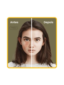 Pomada Micosan A Solução para Eliminar Manchas de Olheiras 50g - amarelo - Visão 4