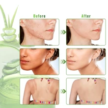 Kynley Gel de aloe vera orgánico de 300ML - crema hidratante natural, crema hidratante para el vello corporal, Envío desde España en 24-72H