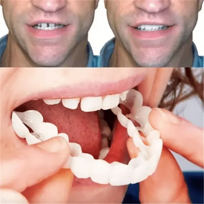 4Pcs Heart-Shaped Box Teeth Decoration Upper And Lower Teeth Models Comfortable Fit Perfect Smile
