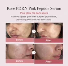 Medicube Collagen PDRN Pink Peptide Serum 30ml, Pink Glow Serum, Peptide, Niacinamide, Hydrating & Moisturizing & Firming, Uneven Skin Tone, Korean Skincare - 30m - View 4