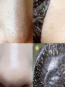 5pcs/10pcs/20pcs Deep Cleansing Blackhead Remover Nose Peel Off Mask - Activated Charcoal Face Mask, Blackhead Removal, Oil Control, Moisturizing, Pore Minimizing, For Smooth Skin, For Men & Women, Skincare Essential For Home & Travel, Mother's Day Gift - Black - View 4