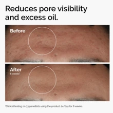 The O-Rdinary Niacinamide 10% + Zinc 1% Serum Day & Night For All Skin Types 30ml - White - View 2