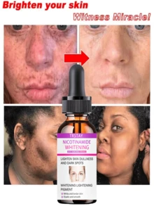 Spot Lightening And Whitening Essence Deeply Repels Dullness, Smoothes Fine Lines, Moisturizes, Nourishes And Reappears The Transparent Skin - 彩色 - 查看 3